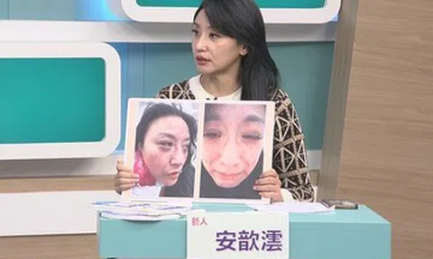 Ca sĩ Tâm Vân bị chồng kém 16 tuổi đánh đến ngất xỉu, dọa giết