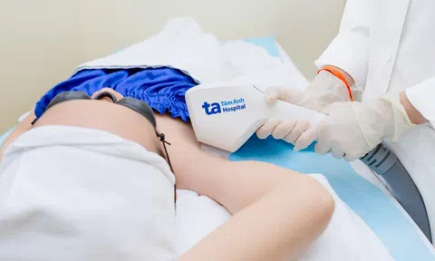 Công nghệ IPL có triệt lông nách vĩnh viễn không?