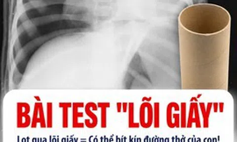BS chuyên khoa Nhi tiết lộ: Chỉ bằng bài kiểm tra với lõi giấy vệ sinh, cha mẹ có thể ngăn con hóc dị vật