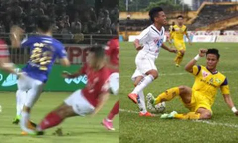 Trước Đoàn Văn Hậu, những pha vào bóng từng khiến bóng đá Việt Nam ám ảnh: Người phải giải nghệ, người mang 7 chiếc đinh trong chân