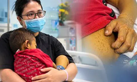 Con 4 tuổi da vàng như nghệ phải thay gan: Mẹ “sốc” khi biết căn bệnh phía sau