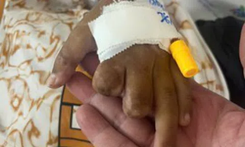 Bé trai 10 tuổi sáng đau đầu, chiều hôn mê và xuất hiện tử ban vì não mô cầu: "Tối đó chuyển lên Nhi Đồng Thành Phố, nhưng em không qua khỏi"